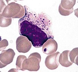 Los  linfocitos asesinos naturales T, natural-killer T cells o NKT (foto NEJM).